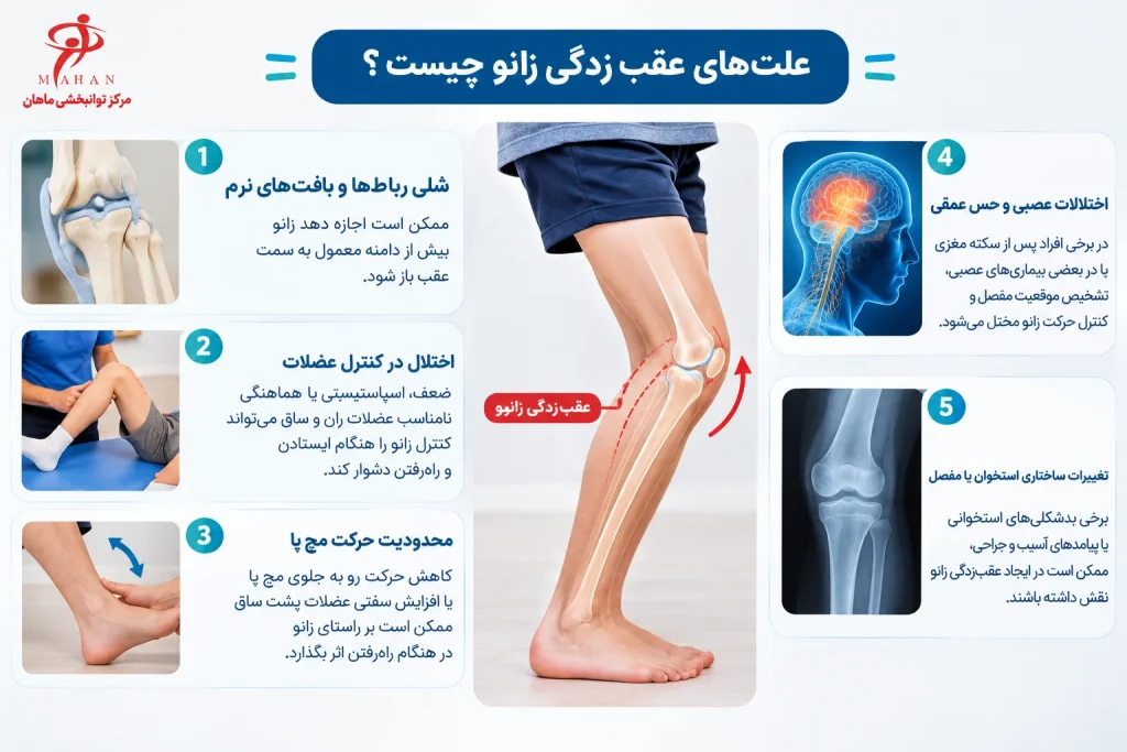 اینفوگرافیک علتهای عقبزدگی زانو یا ژنو رکورواتوم شامل شلی رباطها، اختلال کنترل عضلات، محدودیت حرکت مچ پا، اختلالات عصبی و تغییرات ساختاری استخوان و مفصل، مرکز توانبخشی ماهان