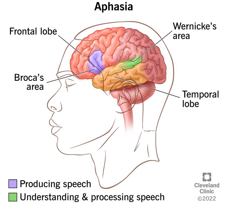 گفتاردرمانی آفازی شمشیری مهرآباد